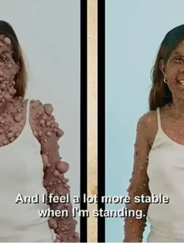 dr osborne charmaine tumors